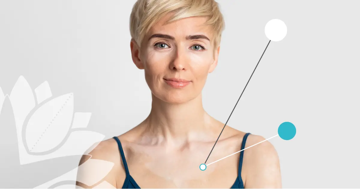 Auto-immuunziekte | Starfish.Health | aandoening | ziekte